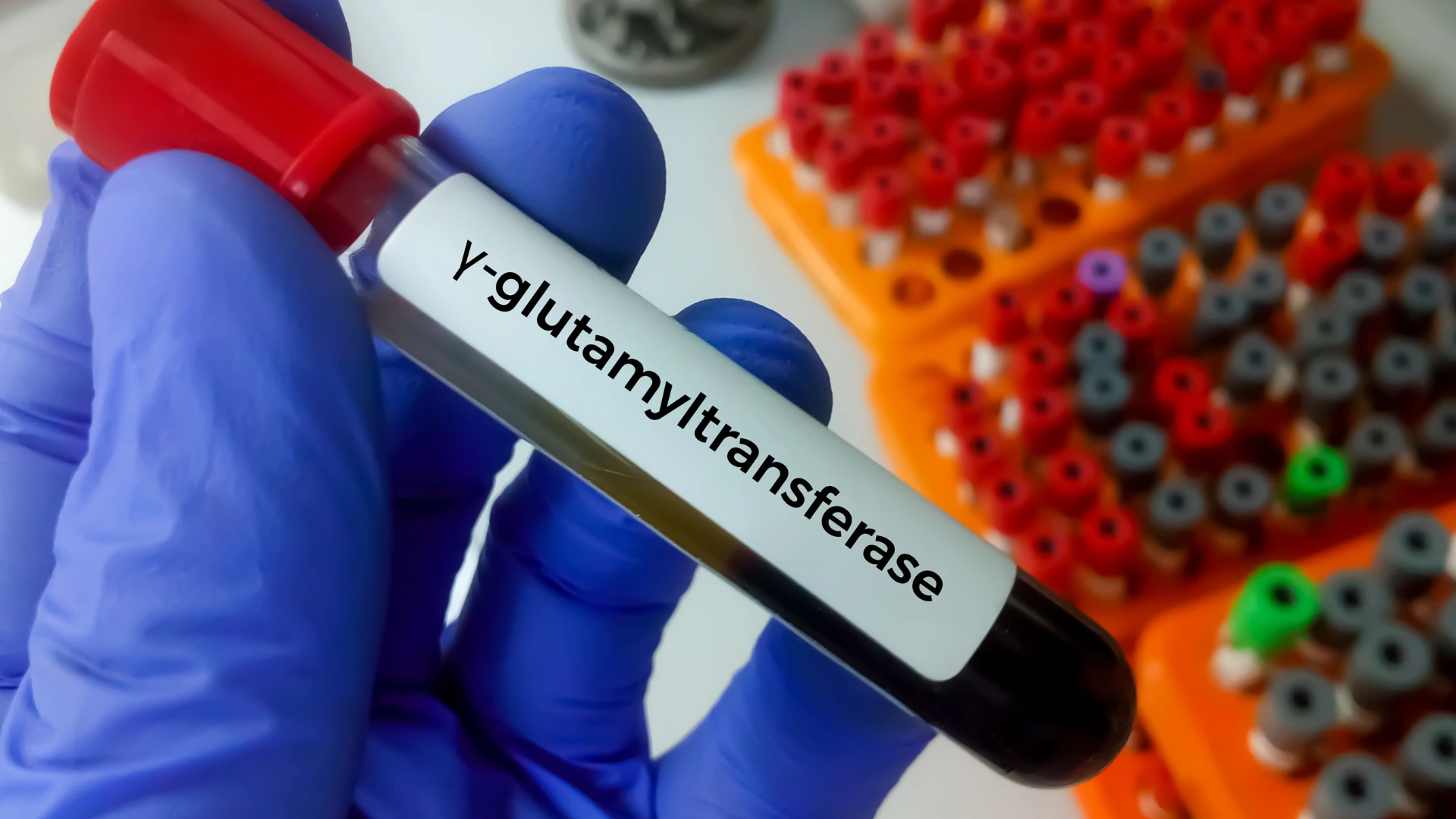 glutathione injection price in islamabad pakistan What is the Cost of Glutathione Injections in Islamabad?