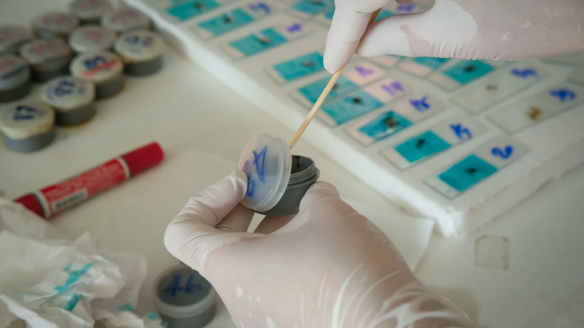 Stool Culture Test | Detect Bacterial Infections in the Gut 🧫