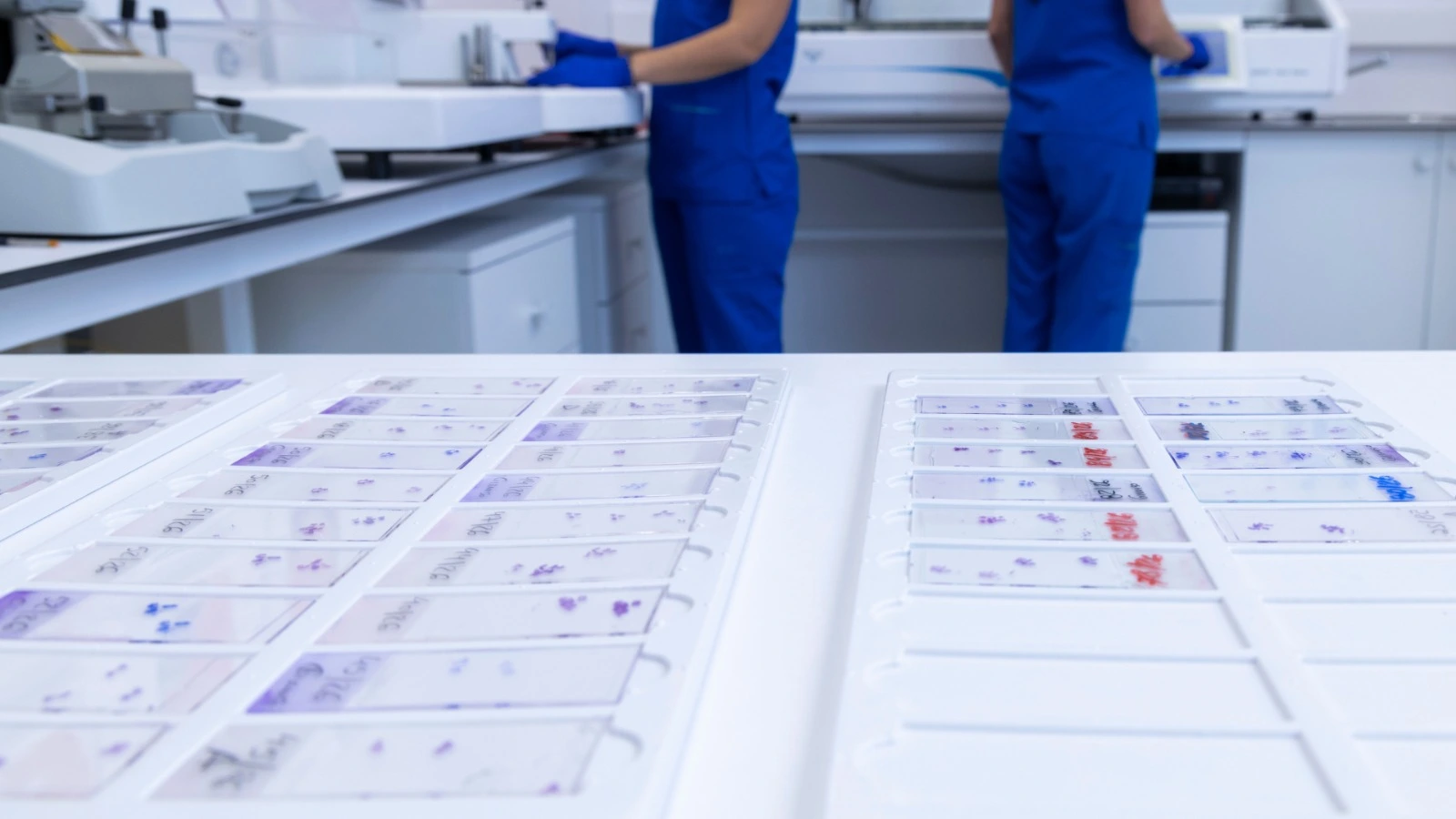 biopsi e traktit tretes tirane