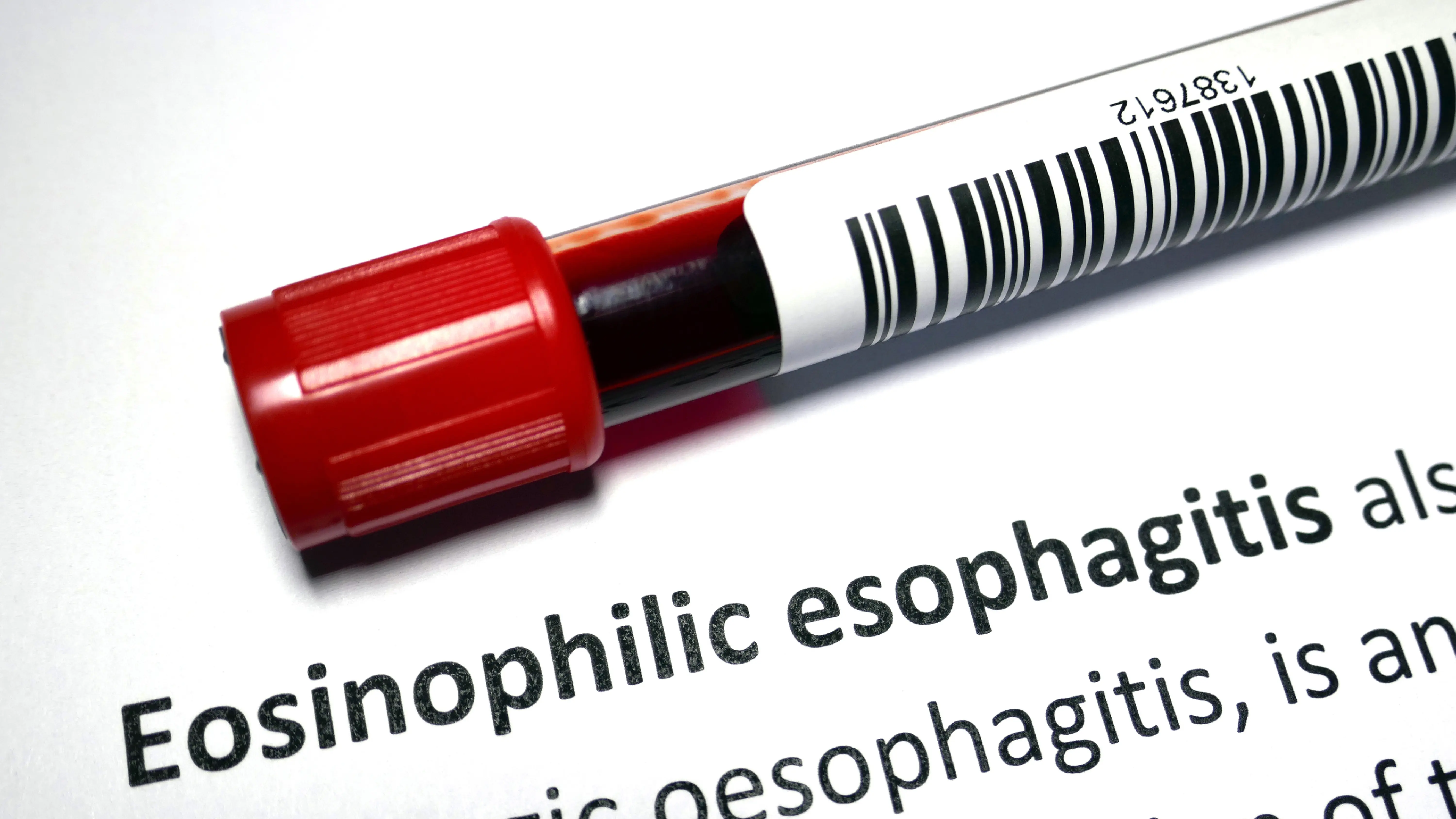 eosinophilic esophagitis