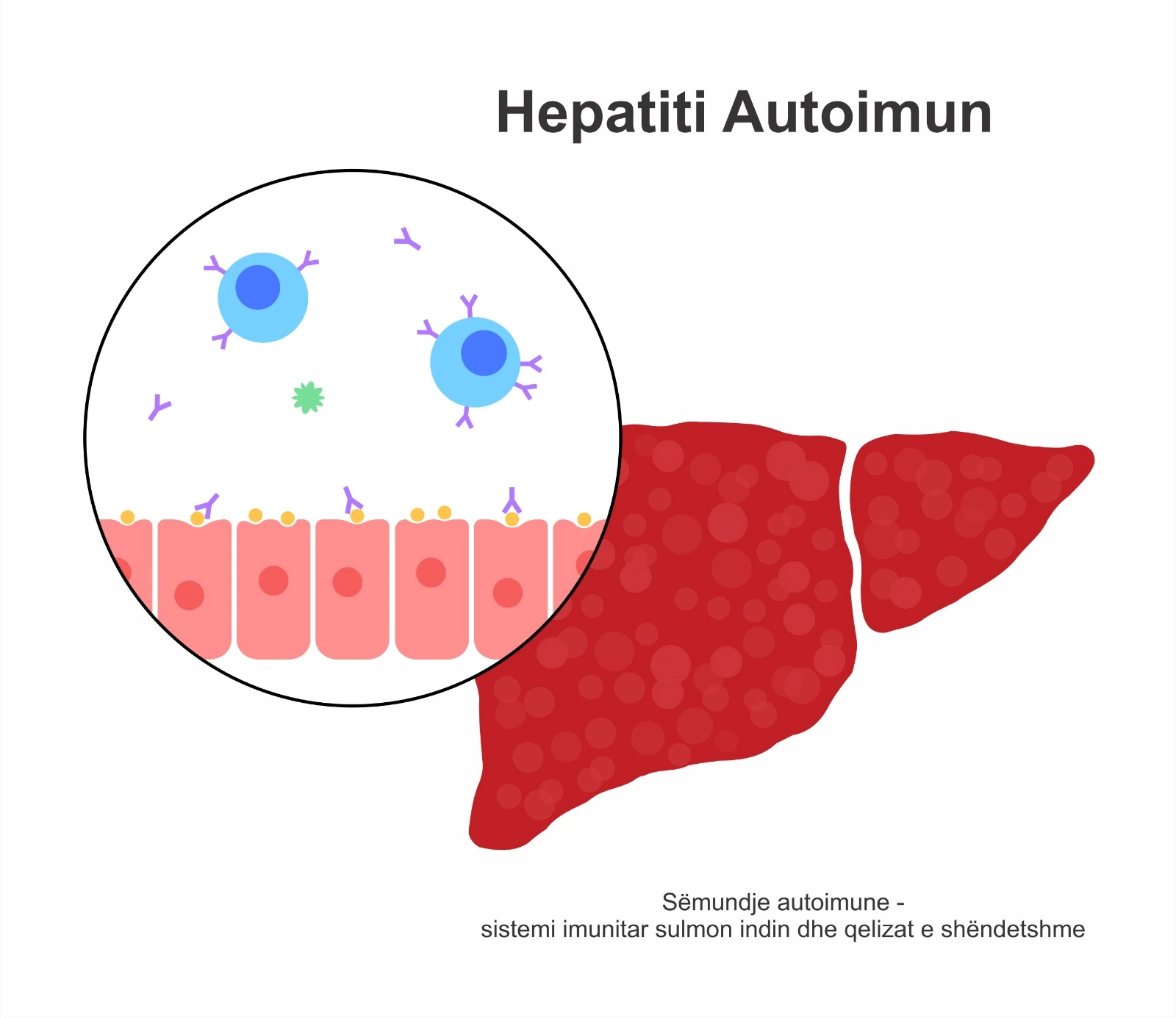 Hepatiti autoimun